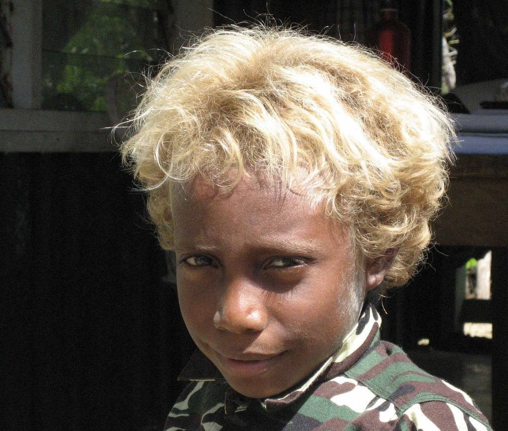 The Beautiful children of Solomon Island in Their Blond Glory