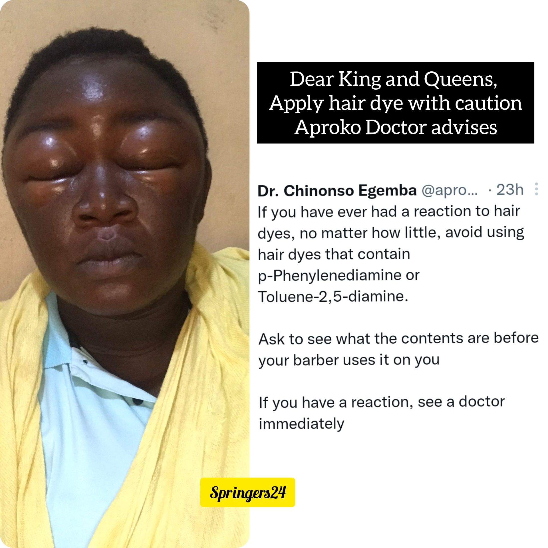 You might have this reaction if you dye your hair with this Chemical- Aproko Doctor
